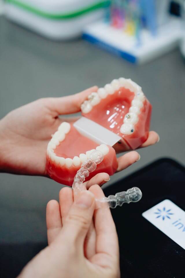 Invisalign in fullerton