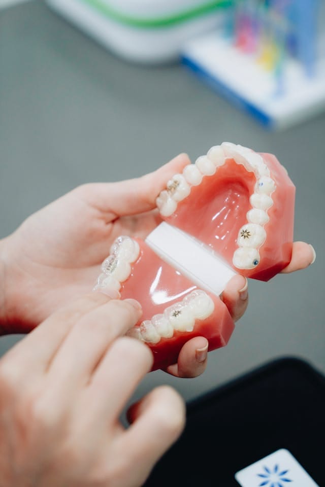 dental crowns