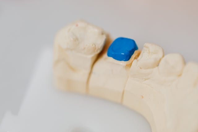 colored fillings