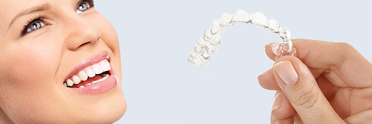 Fullerton 7 Things Parents Need to Know About Invisalign Teen