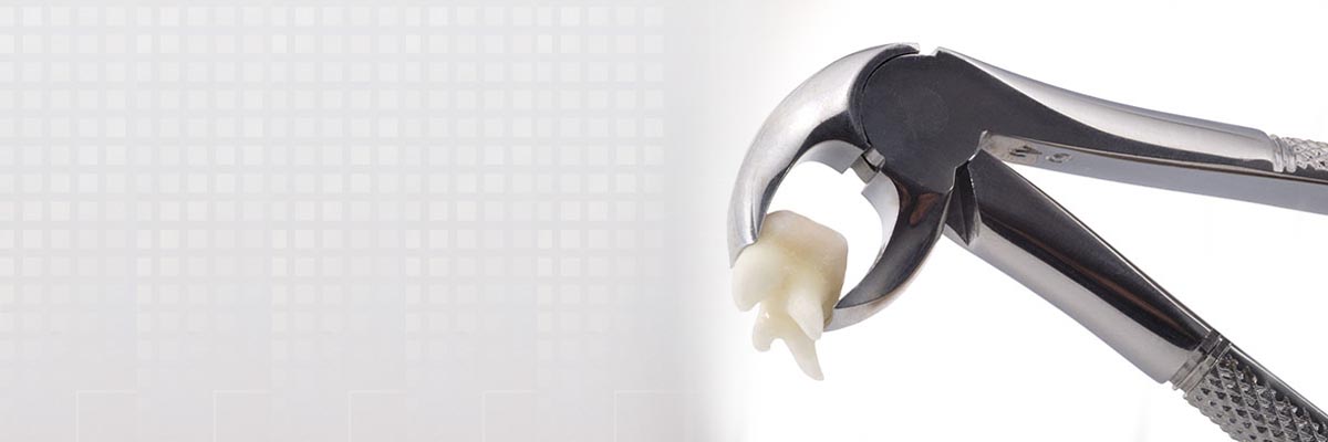 Fullerton Tooth Extraction